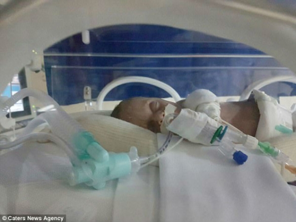 Врачи совершили невероятное: двое малышей родились через 123 дня после смерти матери