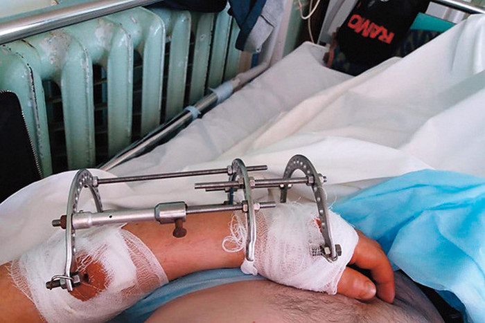 "Как бросил пить, так начал калечиться": Евгений Осин в ужасе от пребывания в больнице