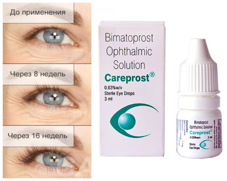 Карепрост средство для роста и красоты ресниц (Careprost for Eyelashes) 3 мл - Т