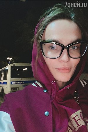 «Синяк на пол-лица»: Алена Водонаева запечатлела себя после операции